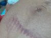 Mulher grávida é agredida e perde o bebê após confusão na cavalgada de Buritirana