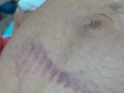 Mulher grávida é agredida e perde o bebê após confusão na cavalgada de Buritirana