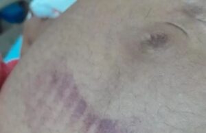 Mulher grávida é agredida e perde o bebê após confusão na cavalgada de Buritirana